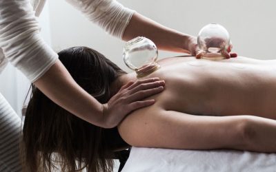 What is Cupping and What are the Benefits?